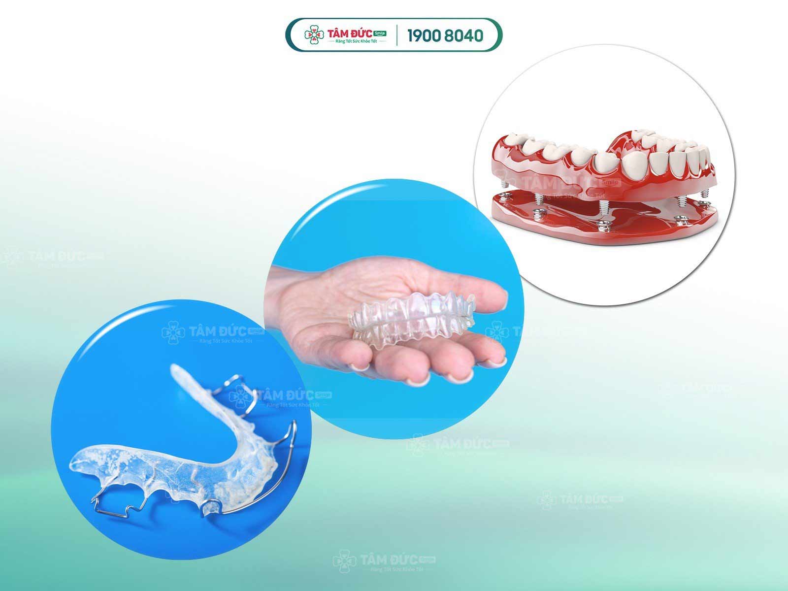 Các loại hàm tháo lắp phổ biến và ưu nhược điểm chi tiết từng loại