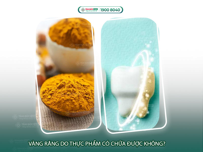 Ăn nghệ làm răng bị vàng: Nguyên nhân, cách xử lý và mẹo làm trắng tại nhà