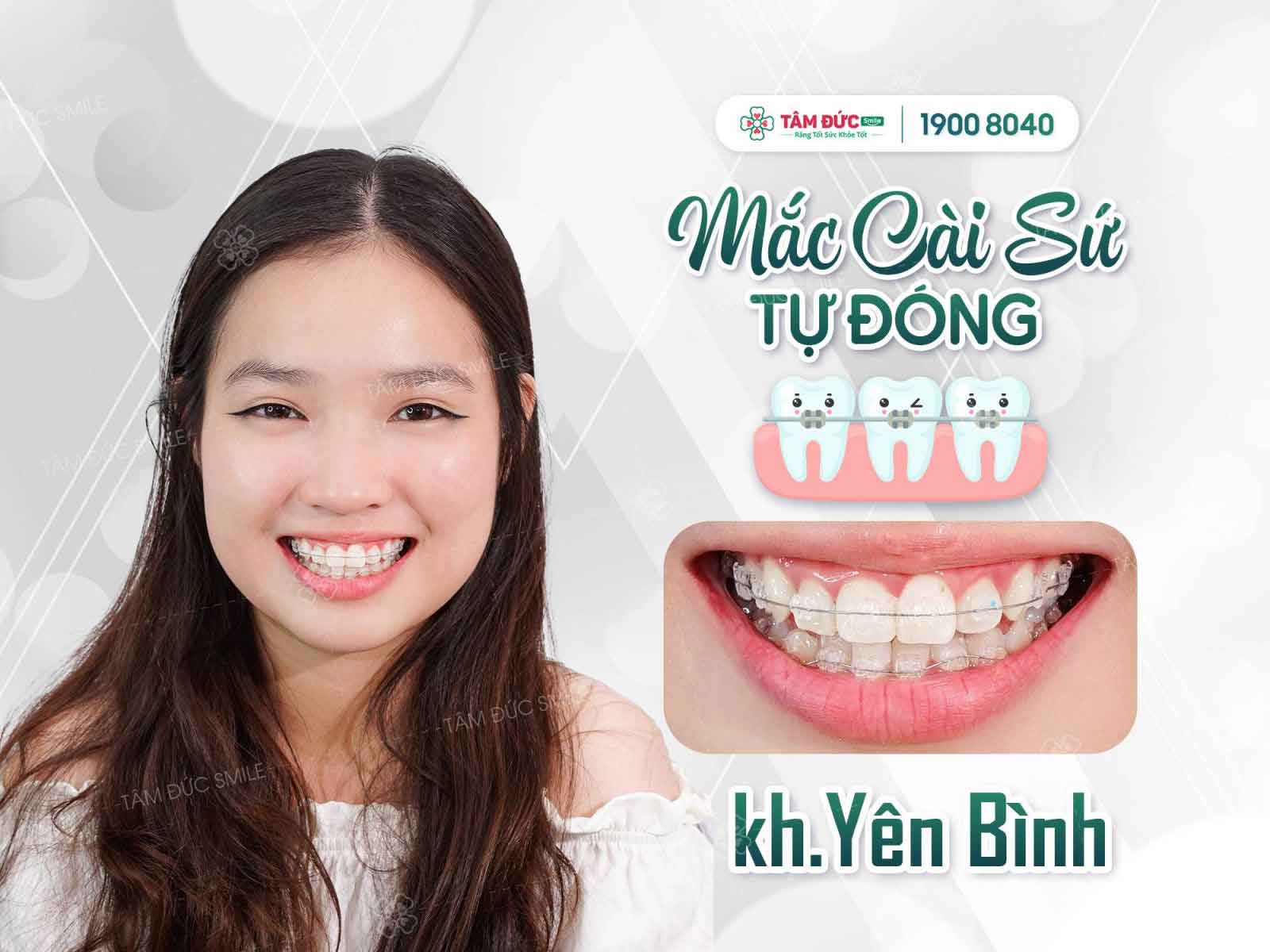 nieng-rang-bang-mac-cai-su
