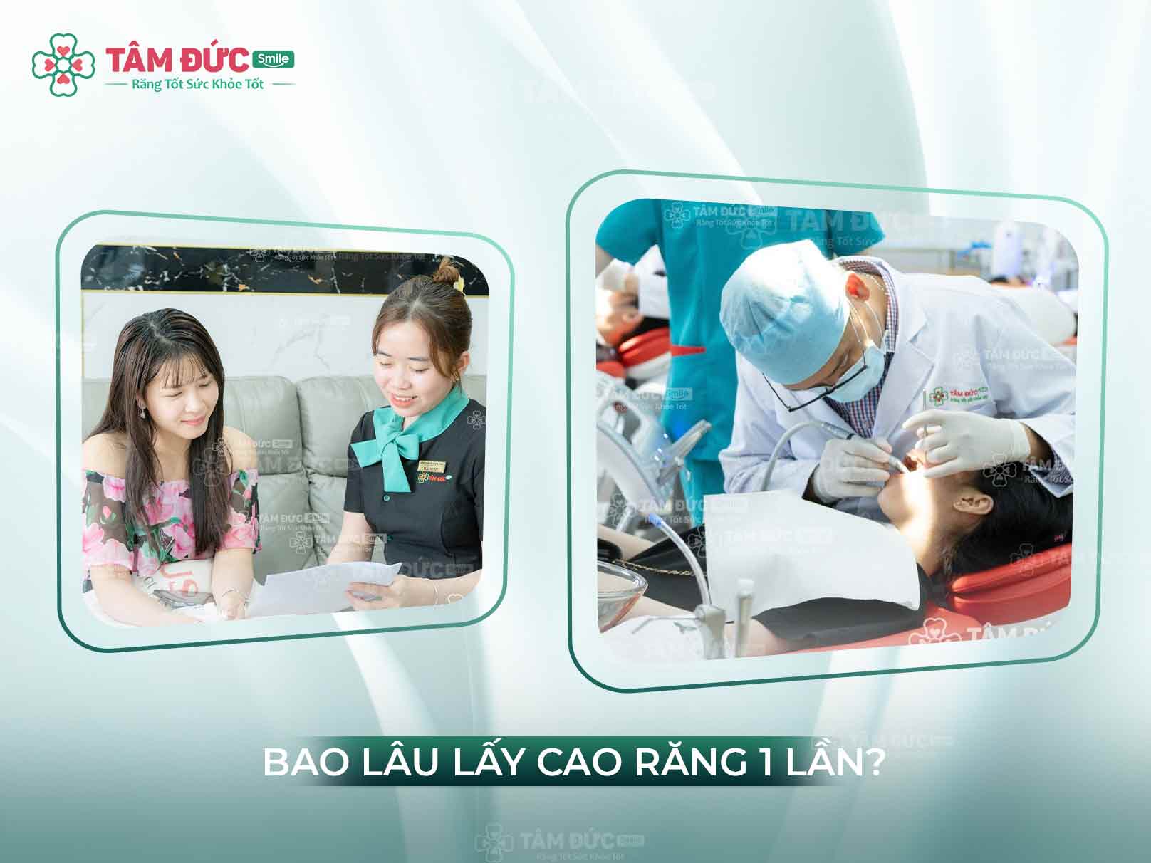 Bao lâu lấy cao răng 1 lần? Lời khuyên từ chuyên gia Nha khoa Tâm Đức Smile