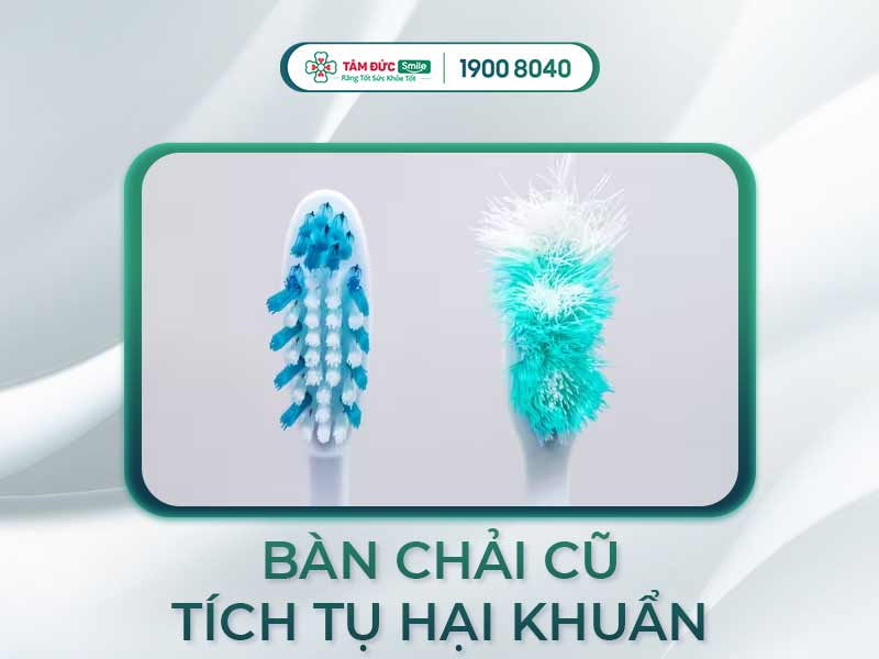 Bao lâu nên thay bàn chải đánh răng 1 lần? Dấu hiệu & thời điểm nên thay mới