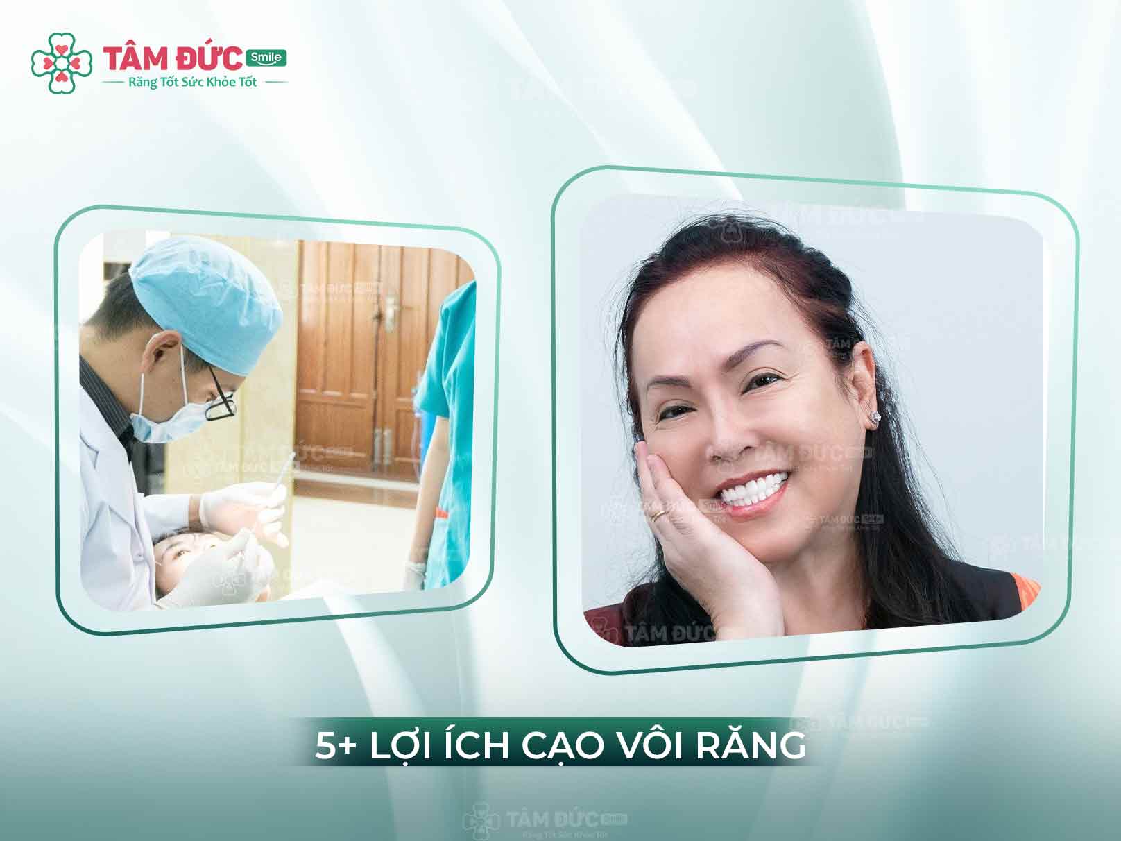 Lợi ích cạo vôi răng: Làm sạch mảng bám, ngăn viêm nướu tại Tâm Đức Smile