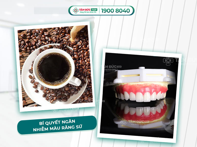 Bọc răng sứ có uống cà phê được không? Cách chăm sóc để không bị ố màu