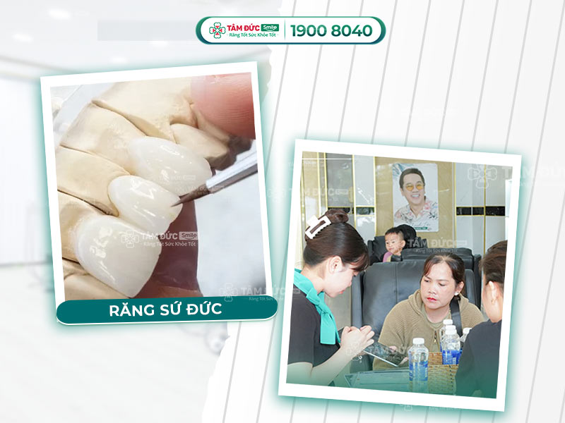 Răng sứ Đức: Ưu điểm, bảng giá & các loại Ceramill, Zolid, Vita tại Tâm Đức Smile