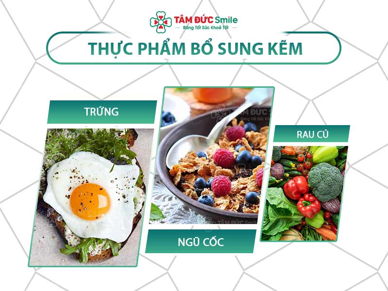 Thực phẩm bổ sung kẽm: Viên uống, kẽm sinh học và lợi ích cho sức khỏe răng miệng