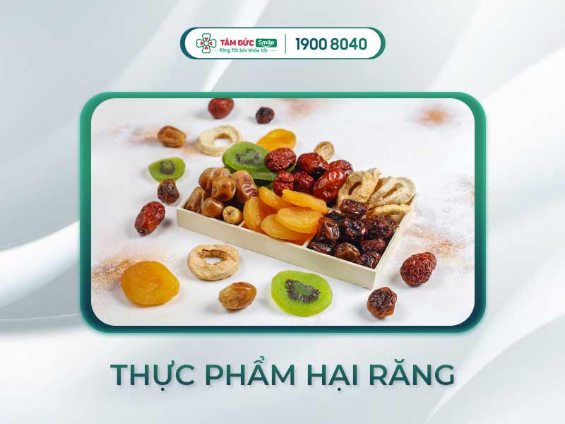 10 loại thực phẩm gây hại cho răng: Cảnh báo bạn nên tránh để bảo vệ men răng