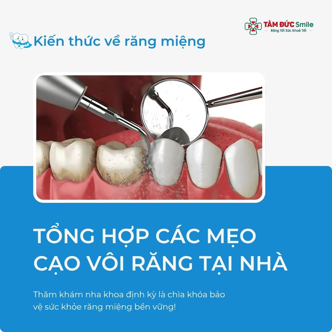 Cạo vôi răng tại nhà: Cách làm sạch mảng bám bằng nguyên liệu tự nhiên hiệu quả
