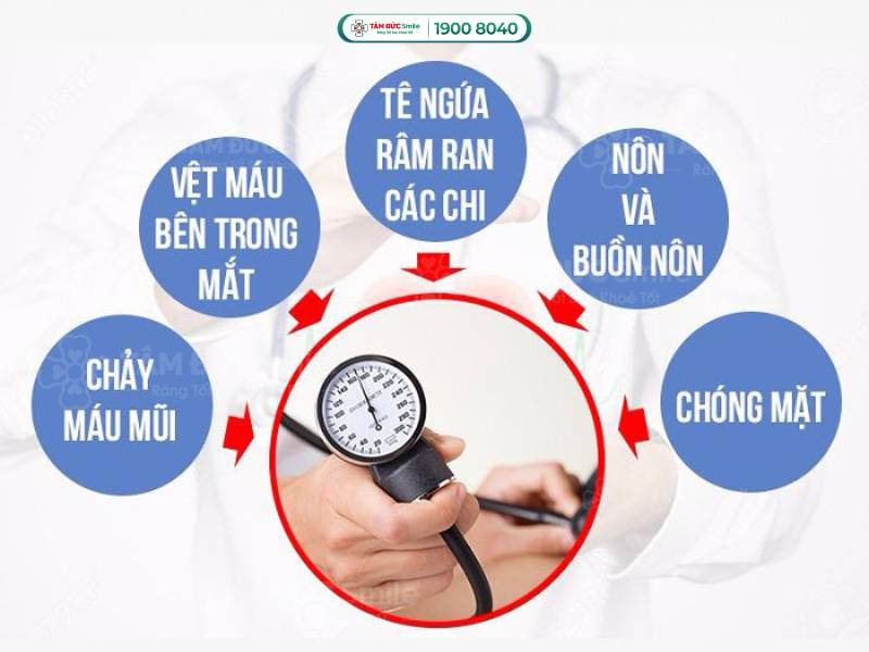 cao máu là gì? Nguyên nhân gây cao máu