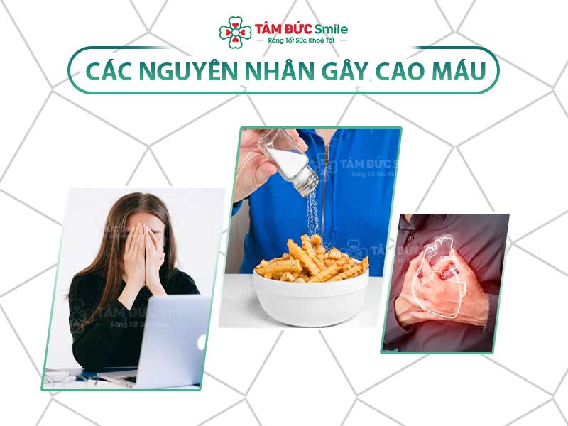 Cao máu là gì? Nguyên nhân, triệu chứng, điều trị và cách kiểm soát hiệu quả