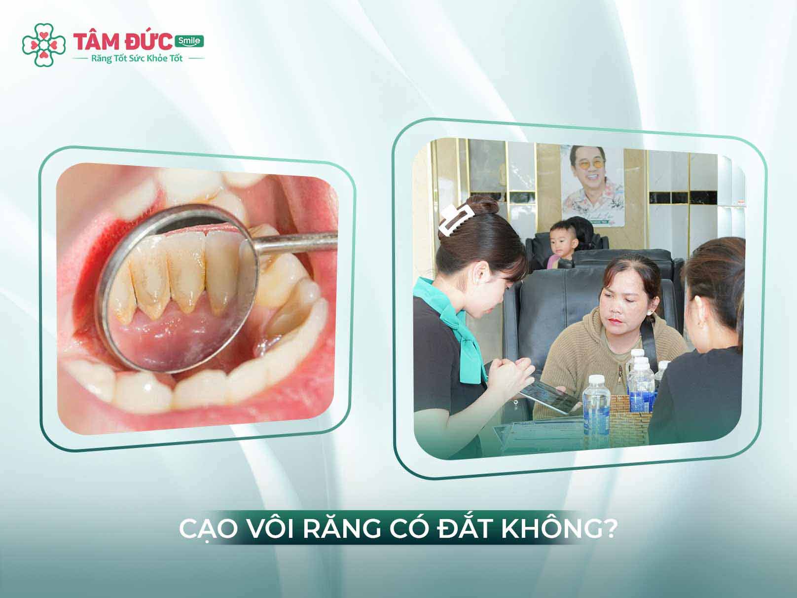 Cạo vôi răng giá bao nhiêu? Bảng giá ưu đãi tại Nha khoa Tâm Đức Smile
