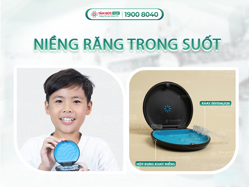Niềng răng trong suốt giá bao nhiêu? Bảng giá Invisalign tại Tâm Đức Smile