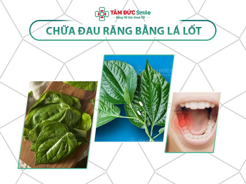 Chữa đau răng bằng lá lốt: 5 cách giảm đau nhanh, an toàn từ bài thuốc dân gian