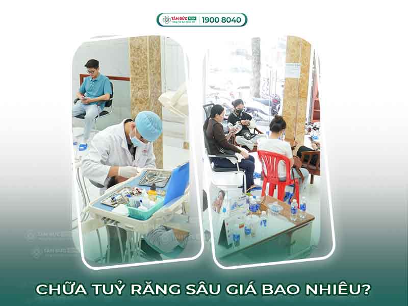 Lấy tủy răng bao nhiêu tiền? Chi phí, quy trình và cam kết tại Nha khoa Tâm Đức Smile