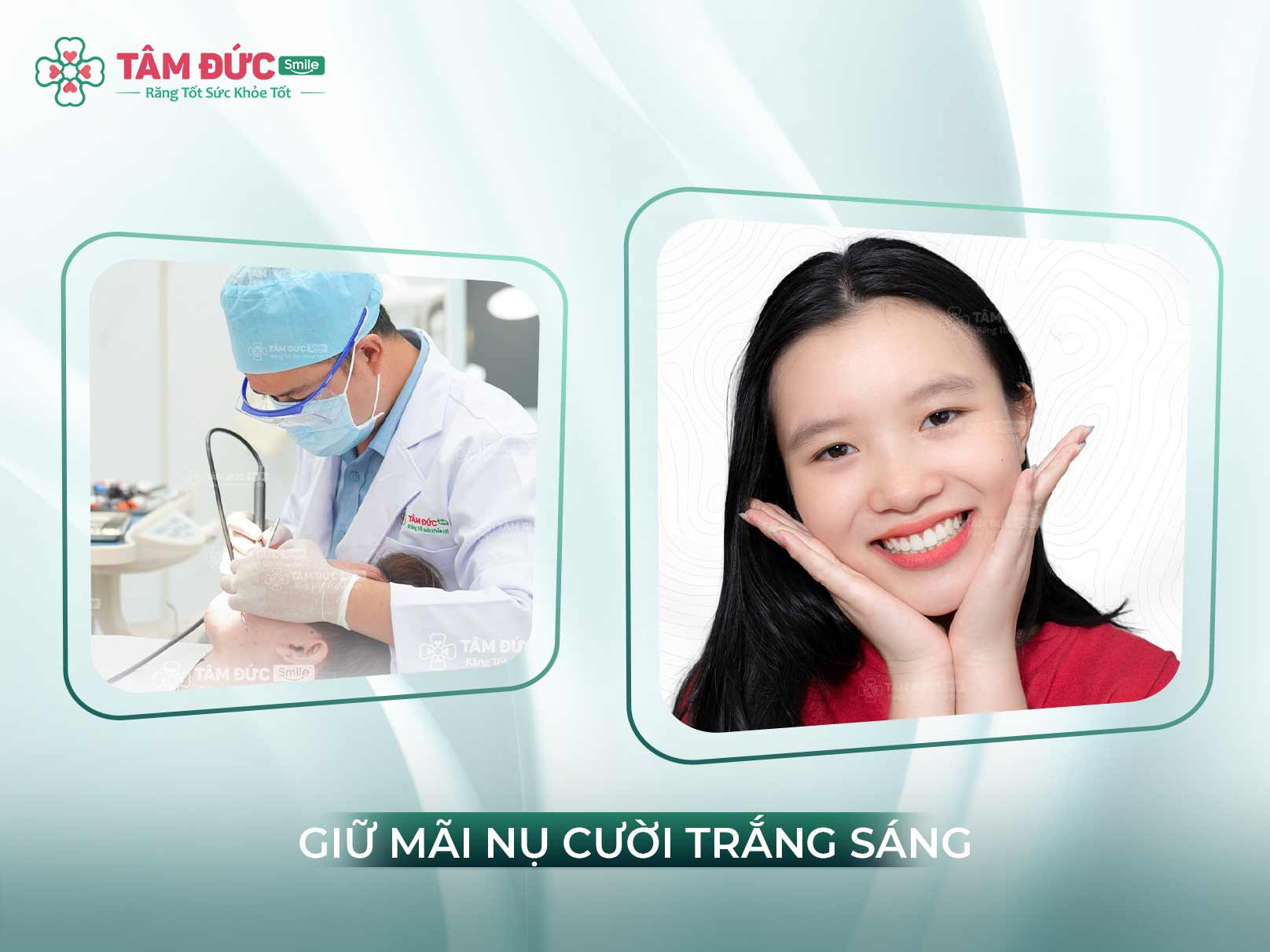 Có nên cạo vôi răng hay không? Lợi ích và thời điểm phù hợp để cạo vôi răng