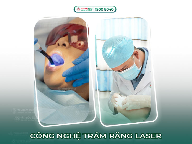 Công nghệ trám răng Laser hiện đại – Không đau, chính xác tại Nha khoa Tâm Đức Smile