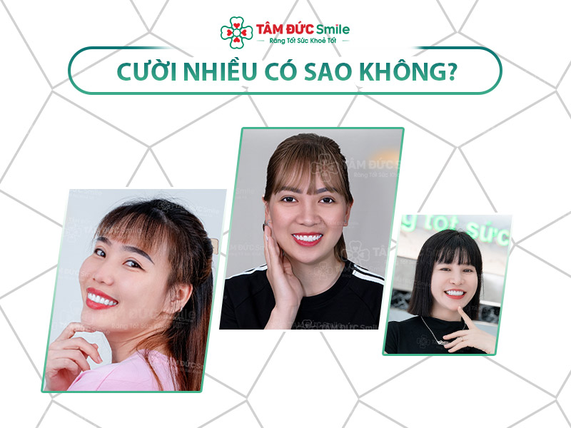Cười nhiều có sao không? Lợi ích, tác hại và dấu hiệu tâm lý cần lưu ý