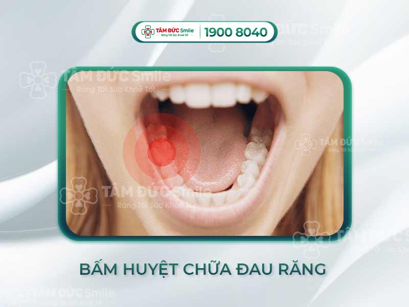 Đau răng bấm huyệt nào? 5 huyệt đạo giảm đau nhanh theo Đông y hiệu quả