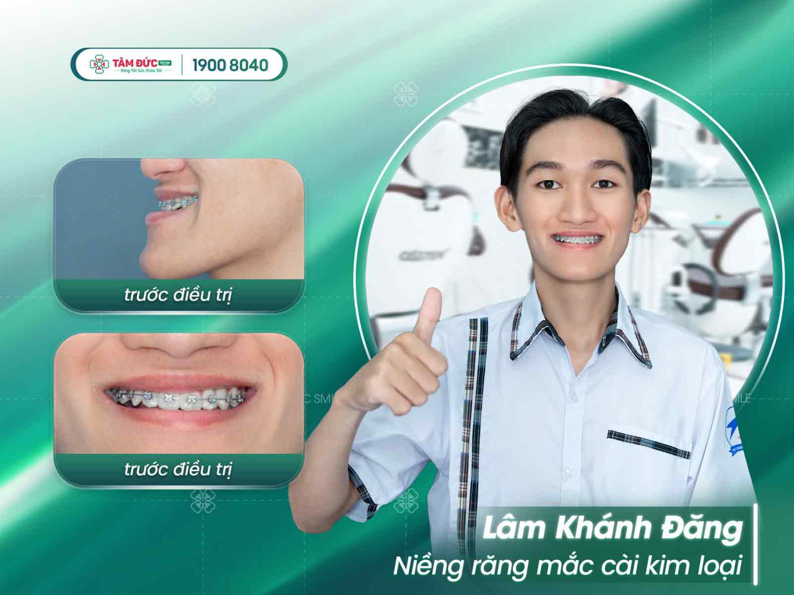 địa chỉ niềng răng đẹp uy tín và hiệu quả