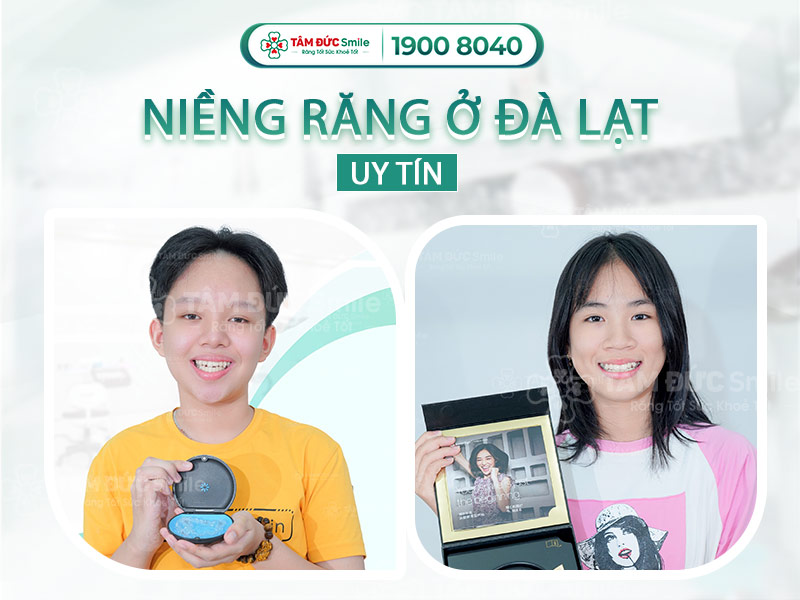 Niềng răng ở Đà Lạt: Giá, phương pháp và địa chỉ nha khoa uy tín nên chọn