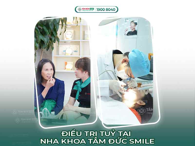 Điều trị tủy răng không đau: Quy trình, chi phí và lưu ý tại Nha khoa Tâm Đức Smile