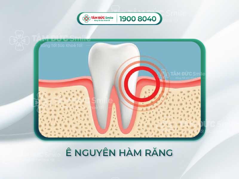 Cách trị ê hàm răng hiệu quả: Giải pháp cho răng ê buốt, nhạy cảm, viêm nướu