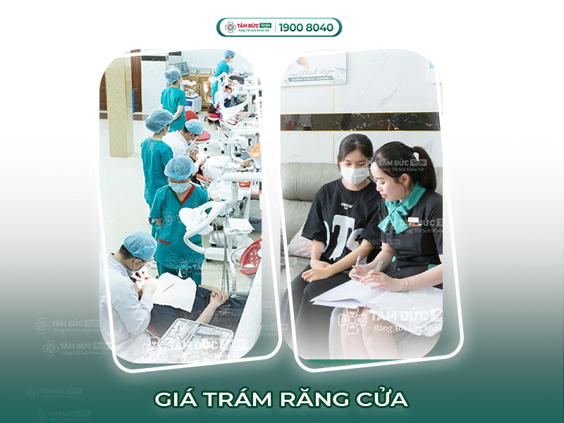 Trám răng cửa thẩm mỹ giá bao nhiêu? Bảng giá trám composite tại Tâm Đức Smile