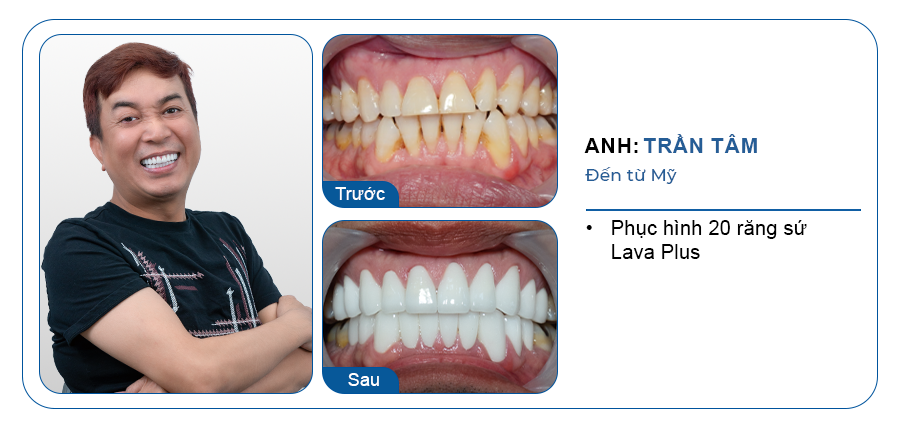 ANH TRẦN TÂM