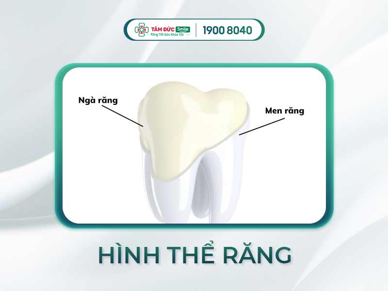 Phân tích hình thể răng: Cách tối ưu nụ cười thẩm mỹ theo tỷ lệ vàng chuẩn