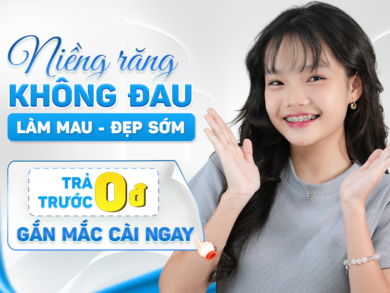 KIẾN TẠO NỤ CƯỜI - NIỀNG RĂNG TRỌN GÓI 10.000.000 VNĐ/HÀM