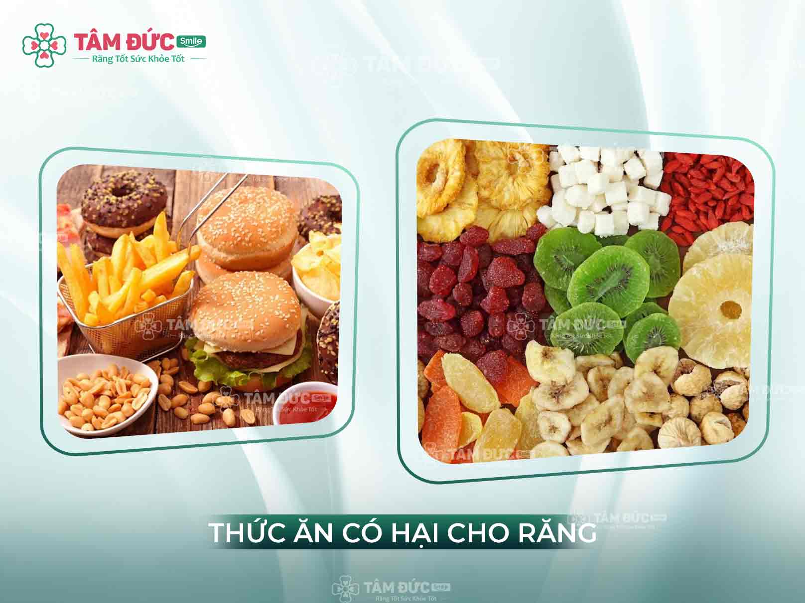 Lấy cao răng xong kiêng gì? Những điều cần tránh để không làm tổn thương răng
