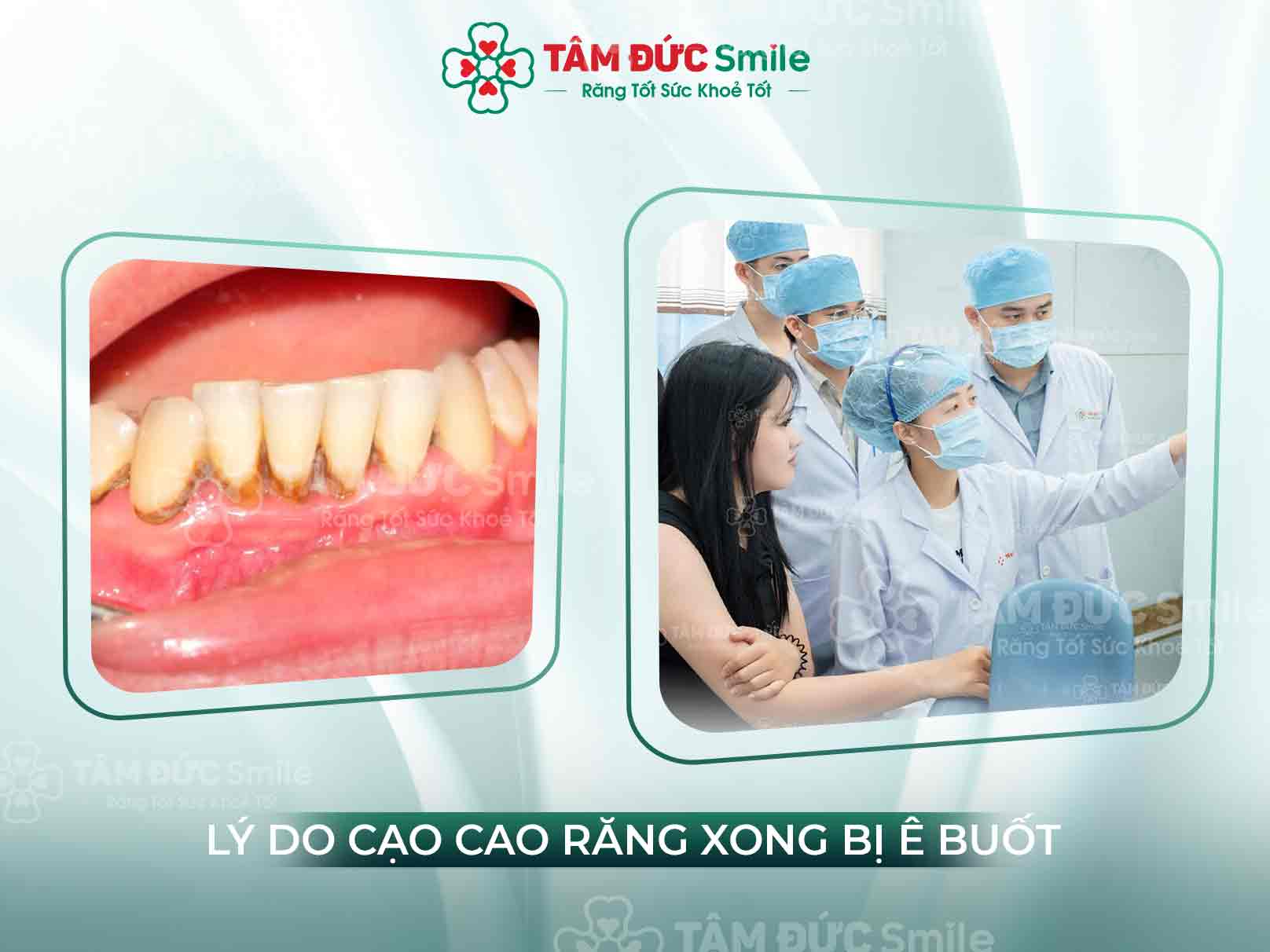 Lấy cao răng xong bị ê buốt: Nguyên nhân và cách khắc phục hiệu quả nhất
