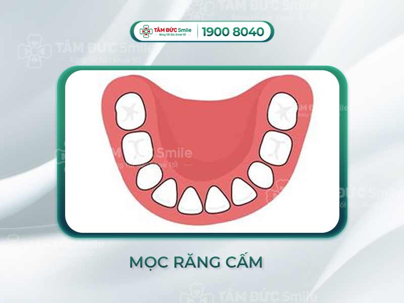Mọc răng cấm ở người lớn có đau không? Cách giảm đau và chăm sóc hiệu quả