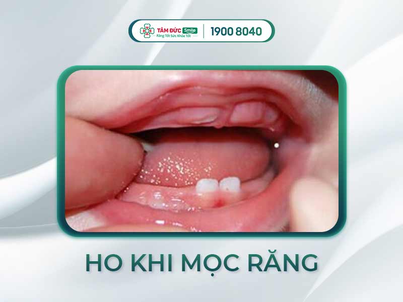Trẻ mọc răng có ho không? Cách nhận biết triệu chứng & xử lý hiệu quả tại nhà