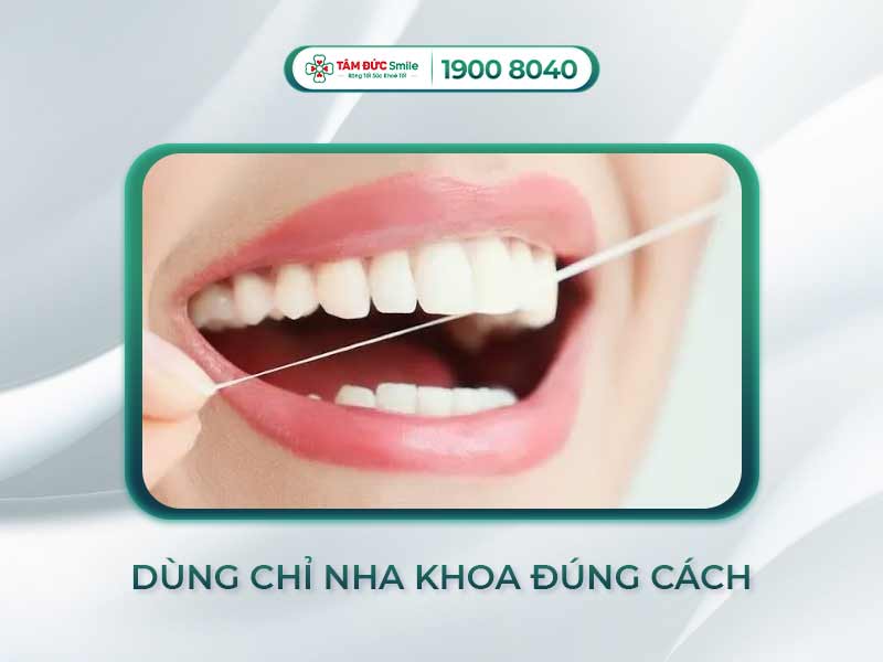 Dùng chỉ nha khoa bị chảy máu: Nguyên nhân, cách xử lý và hướng dẫn an toàn