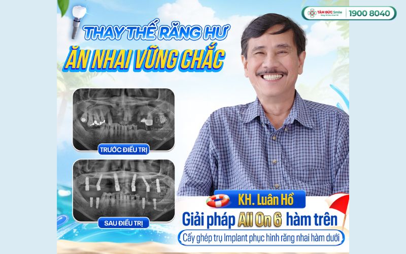 nha-khoa-tphcm-4