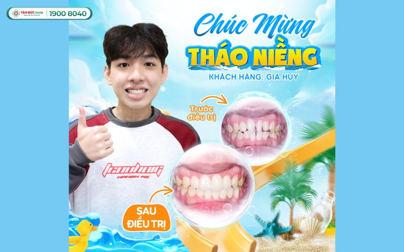 nha-khoa-tphcm-5