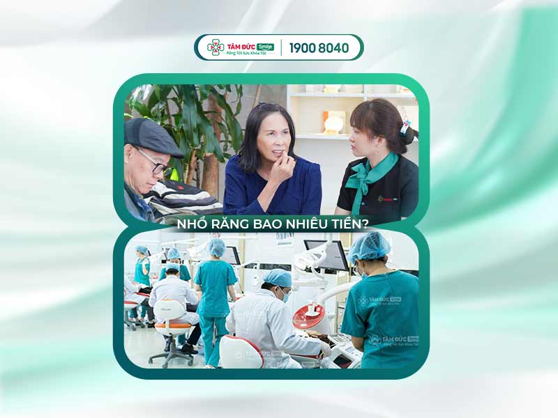 Bảng giá nhổ răng mới nhất: Giá nhổ răng khôn, răng sâu tại Nha khoa Tâm Đức Smile
