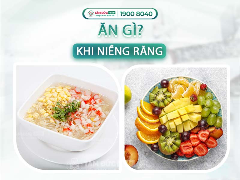 Niềng răng nên ăn gì? 18 món ăn mềm, dễ nhai, tốt cho răng khi đeo mắc cài