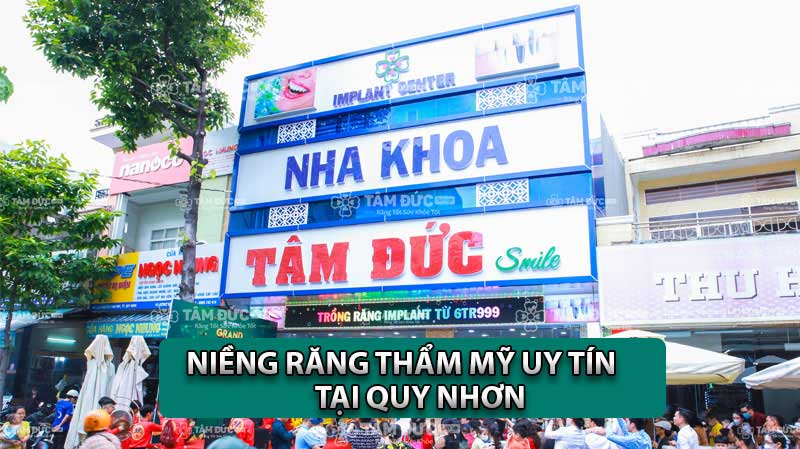 Niềng răng Quy Nhơn: Địa chỉ uy tín, nhiều phương pháp hiện đại, giá hợp lý