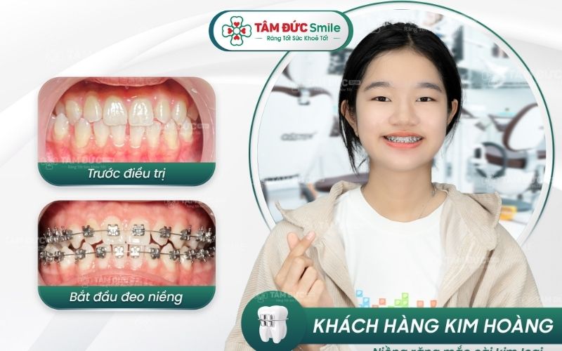 nieng-rang-thua-gia-re-4