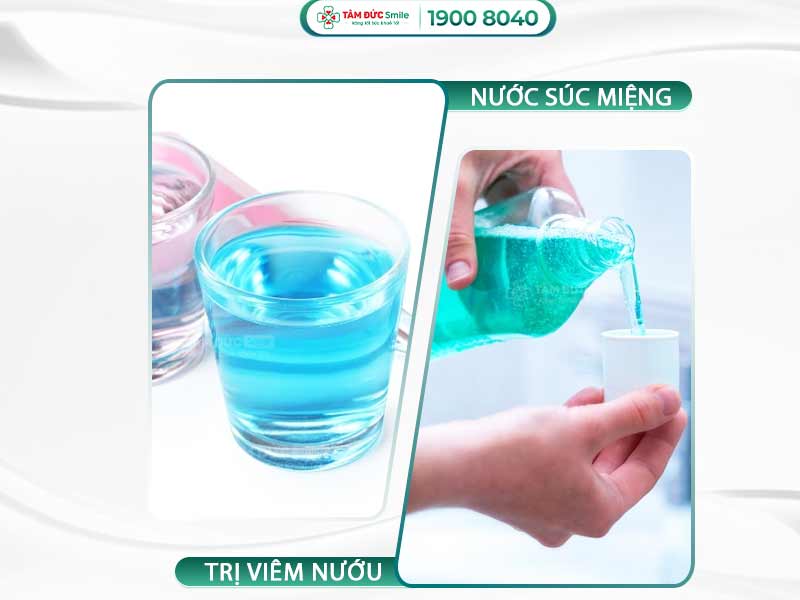 Nước súc miệng trị viêm nướu: Giảm sưng đỏ, kháng khuẩn, không gây khô miệng