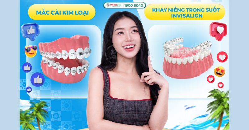 So sánh các phương pháp niềng răng: Invisalign, mắc cài sứ, kim loại hiện đại