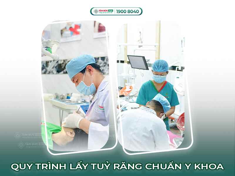 Chi tiết quy trình lấy tủy răng an toàn, không đau tại Nha khoa Tâm Đức Smile