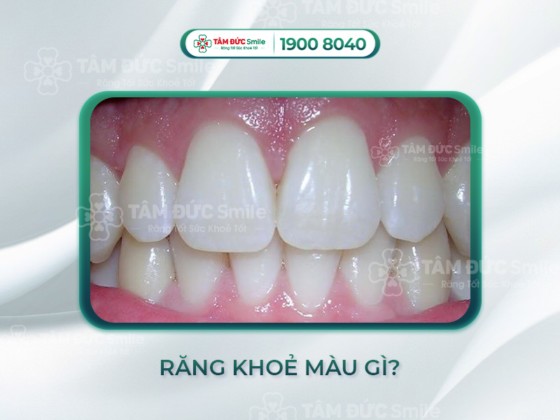 Màu răng tự nhiên: Bảng màu chuẩn, yếu tố ảnh hưởng & cách giữ màu gốc
