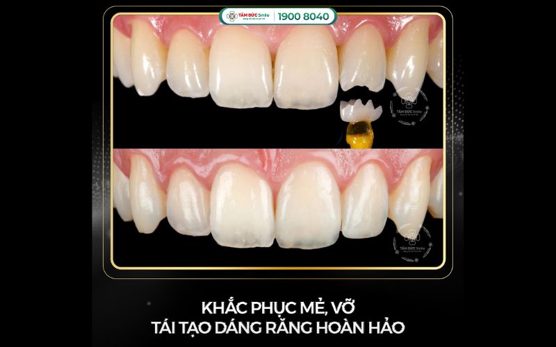 rang-me-5