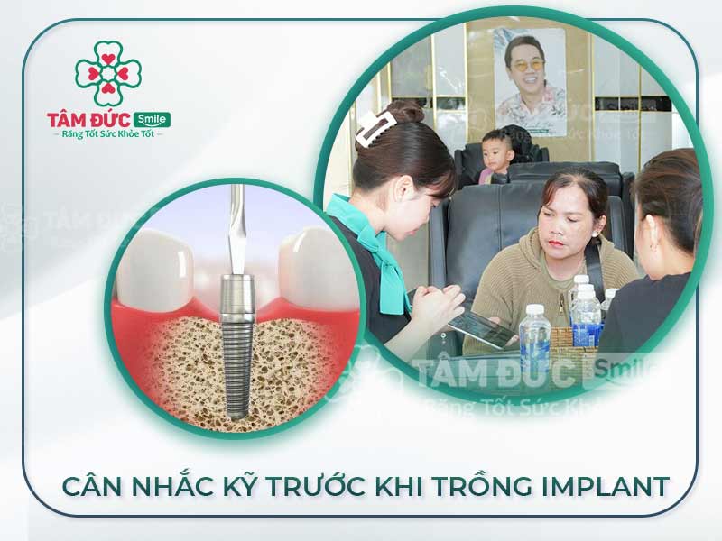 7 Trường hợp không nên trồng răng implant và nguy cơ biến chứng nguy hiểm