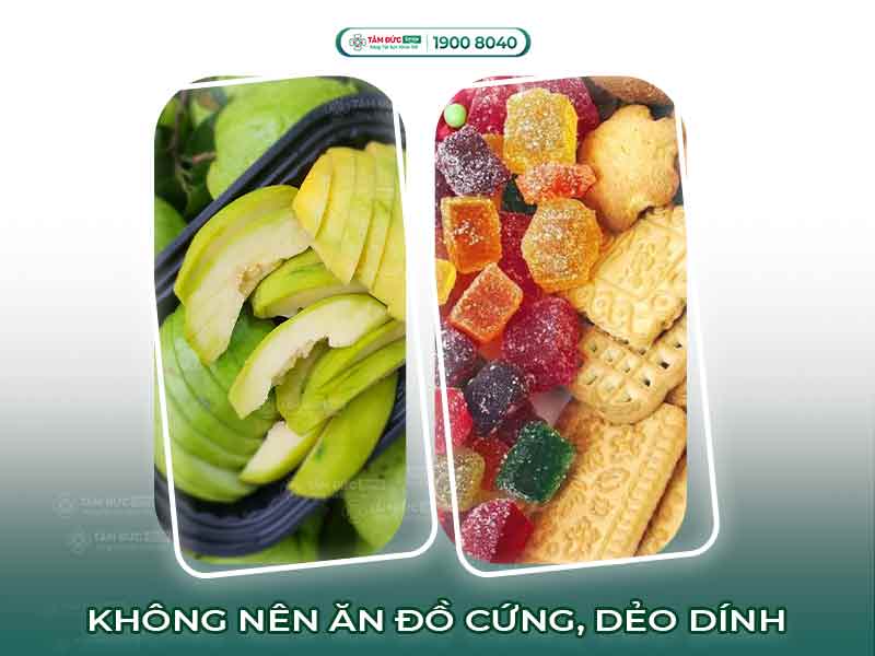 Viêm tủy răng kiêng ăn gì? 10 thực phẩm cần tránh để giảm đau và hồi phục nhanh