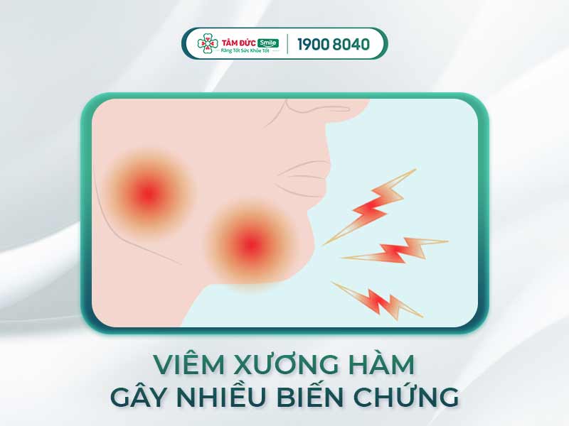 Viêm xương hàm: Nguyên nhân, dấu hiệu, cách điều trị hiệu quả tại Tâm Đức Smile
